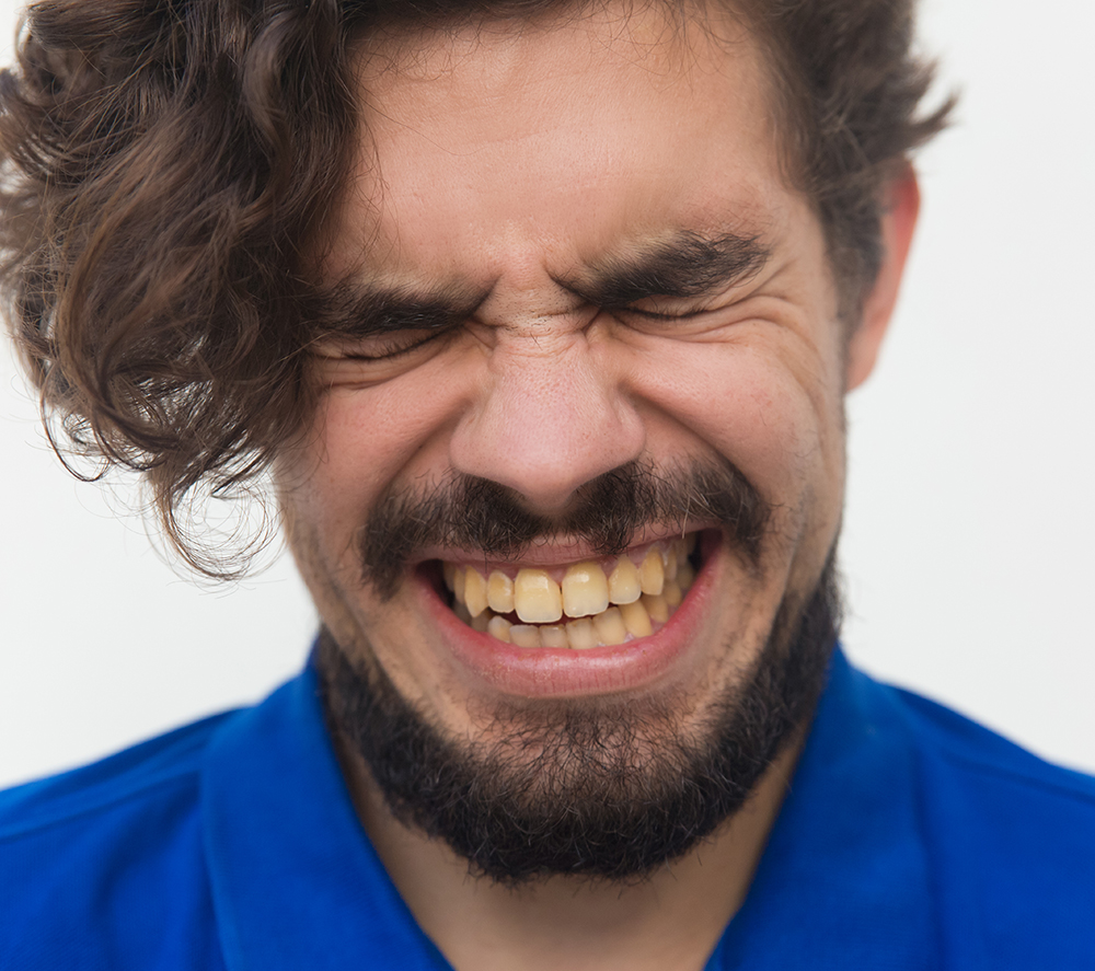 Dişlerdeki Sarı Lekeler Nasıl Geçer?